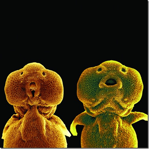 Zebra fish larvae, the one at left with a modified jaw, in an electron microscope photograph taken in Tübingen.